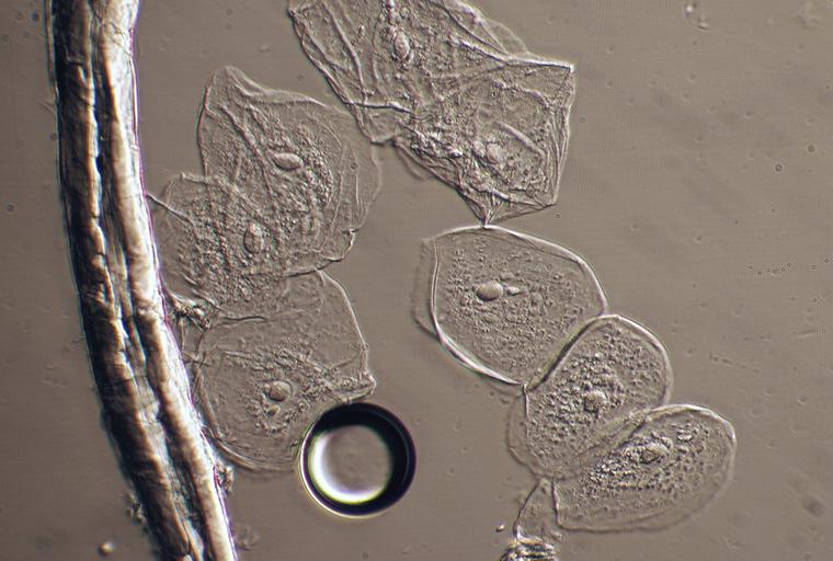 Cheek Cells Under Microscope, Hoffman Modulation Contrast Microscope, Taken with Sony DSLR Camera