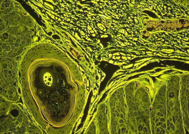 Tissue Sample Under Microscope, Fluorescence Microscope – Ultraviolet, Taken with Nikon Digital Camera