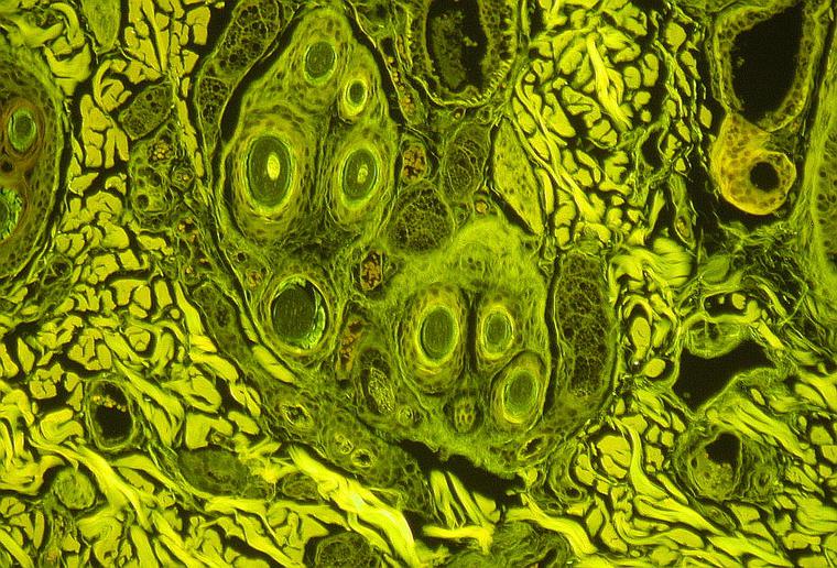 Tissue Sample Under Microscope, Fluorescence Microscope – Ultraviolet, Taken with Nikon Digital Camera
