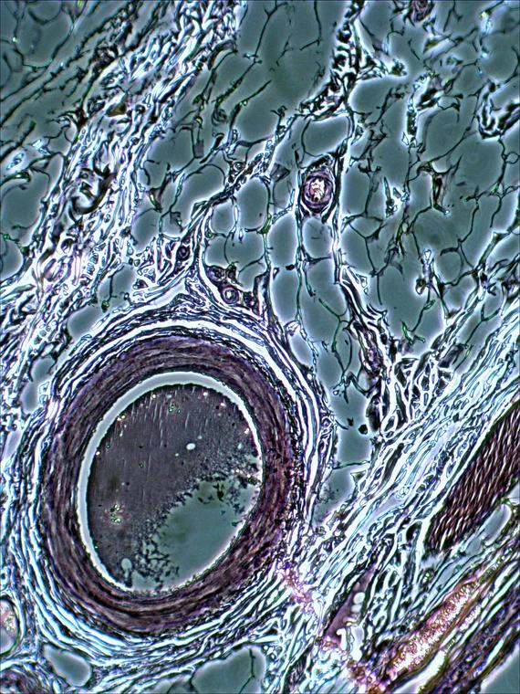 Tissue Sample Under Microscope, Under Phase Contrast Microscope, Taken with USB Camera